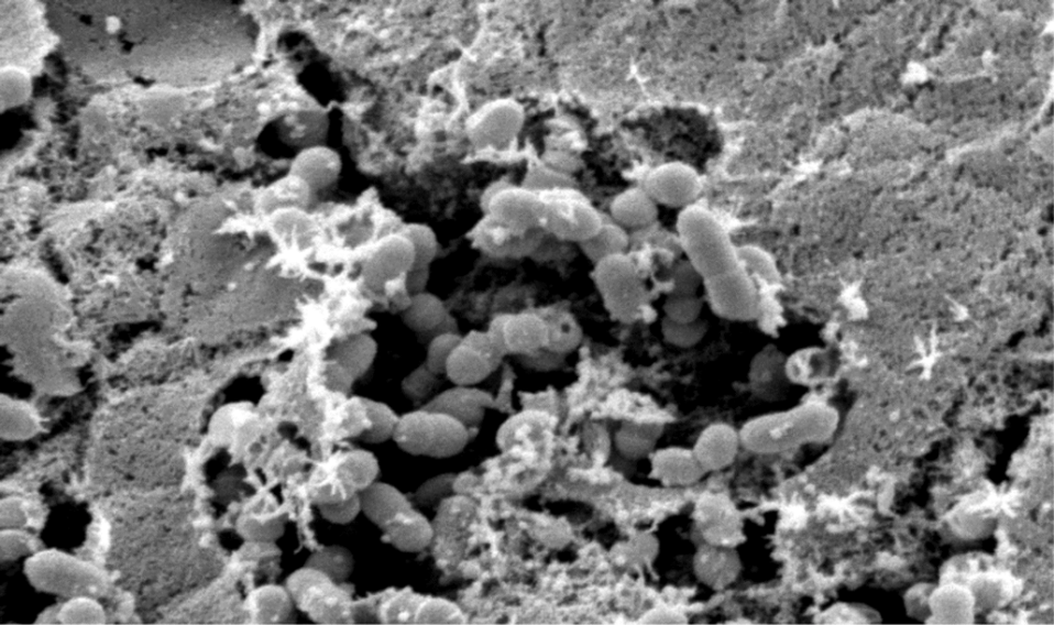 Figure 1. Scanning Electron Microscopy of S. suis in a Sheet of Mucus on the Surface of the Nasopharyngeal Epithelium from a Pig. (Source: Department of Infectious Diseases, Dr. Shiranee Sriskandan (2006). Available from: http://journals.plos.org/plosmedicine/article?id=10.1371/journal.pmed.0030187)